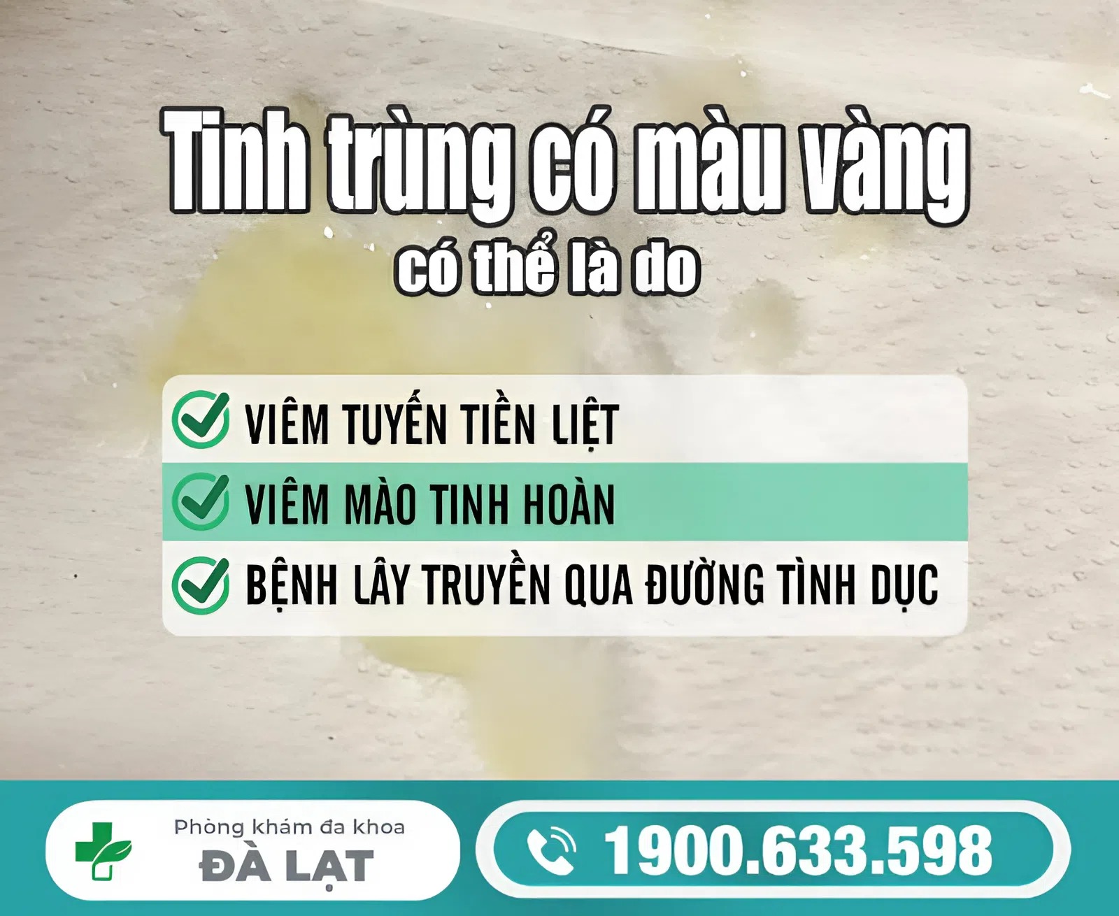 Hình ảnh minh họa